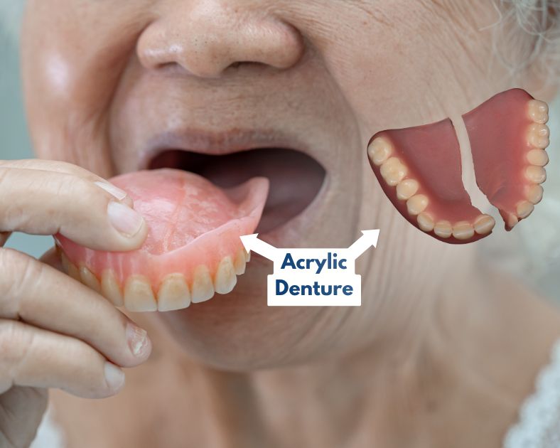 Woman putting in acrylic dentures and image of one broken