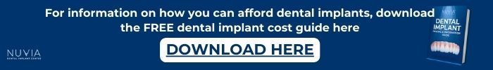 Download dental implant cost guide banner