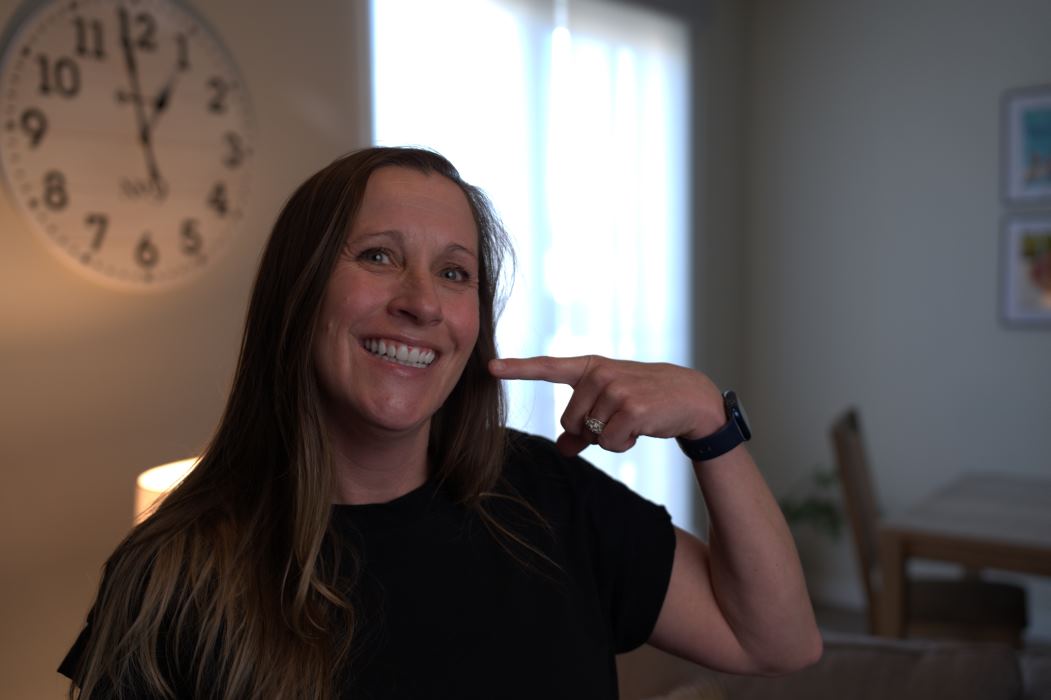 Michelle showing her smile years after dental implants side effects