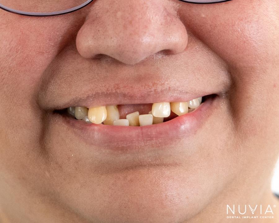Patient who has shared I have really bad teeth what are my options