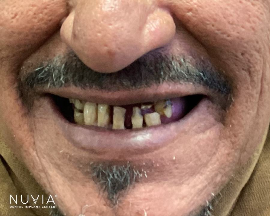 Close up of bad teeth