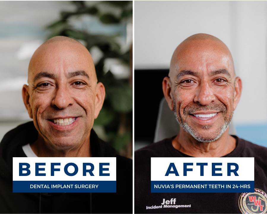 Jeffrey with partial dentures vs Jeffry with dental implants
