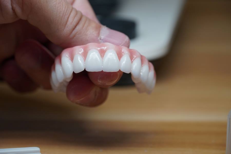 The cost of dental implants in miami can be impacted by the material of prosthetic you get. In this image a person is holding a zirconia dental implant arch.