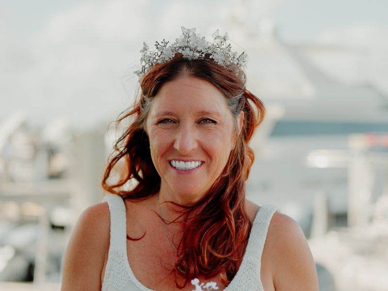Cassie after her wedding without drawbacks of dental implants