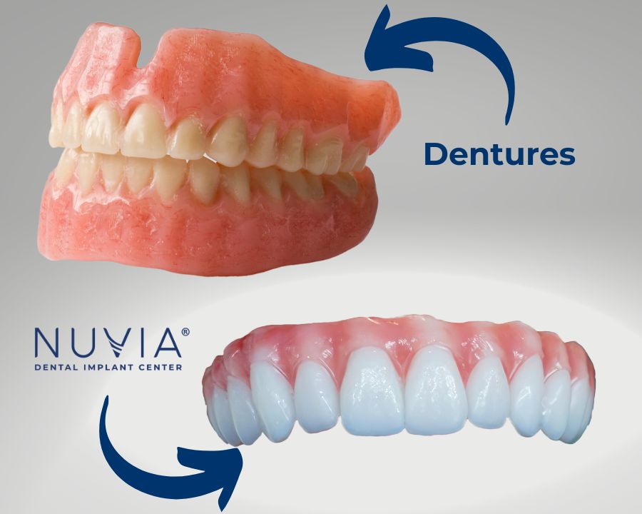 dental implants vs dentures for elderly people against gray background