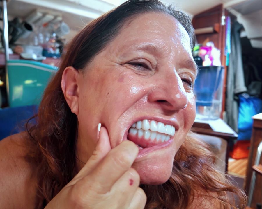 Woman showing off her dental implants instead of bottom dentures