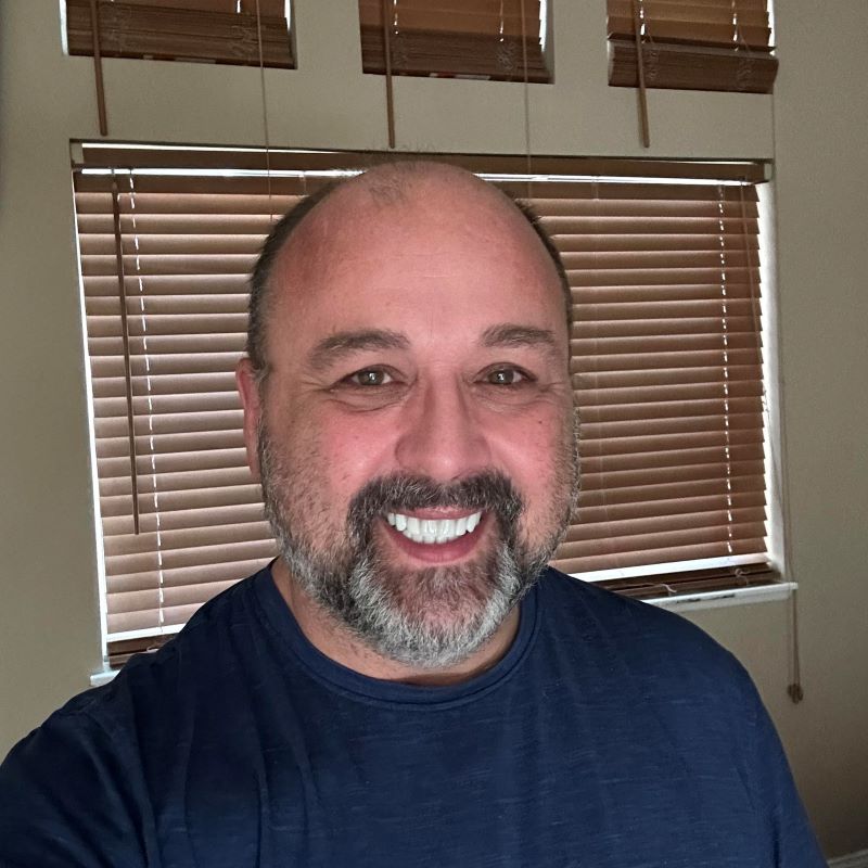 Randee with his full mouth restoration
