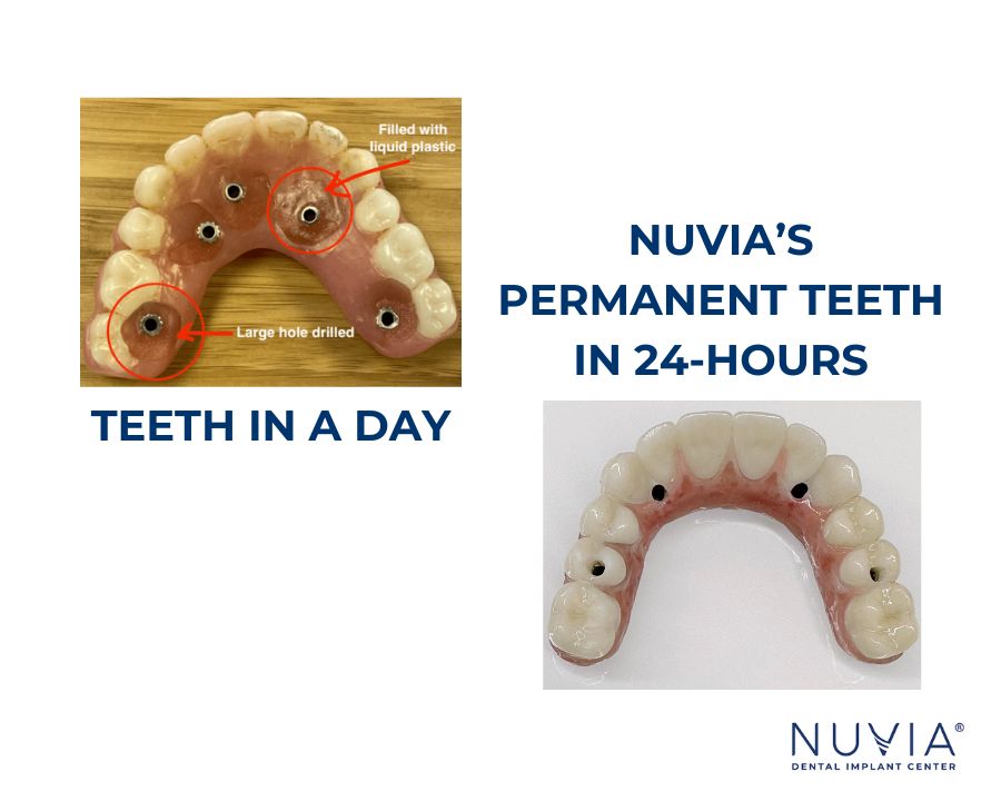 Temporary teeth in a day vs Nuvia's prosthetic