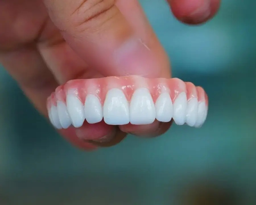 Zirconia teeth used with all on 4 dental implants