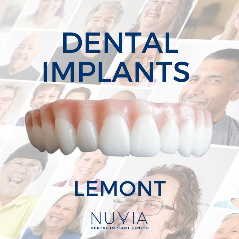 Graphic with dental implant prosthetic in Dallas