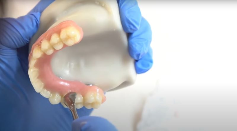 Nuvia Prosthetic in hand