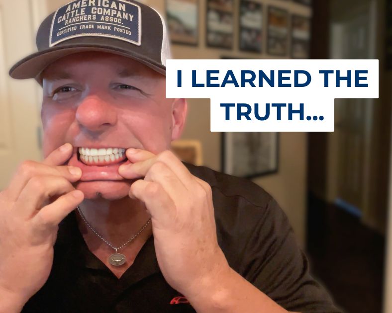 Ricky showing his permanent dental implants