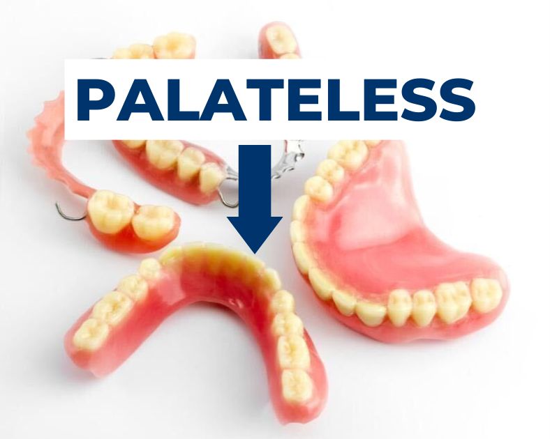 Image of palateless dentures, full, and paritals