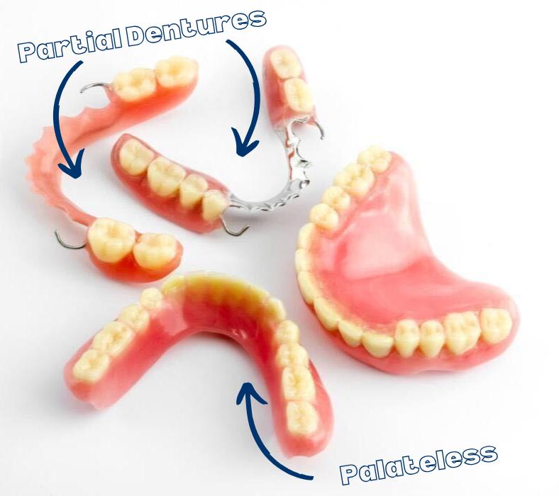 Palateless dentures next to full and partial dentures