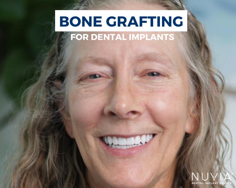 Animation of the need for bone grafting for dental implants due to bone loss