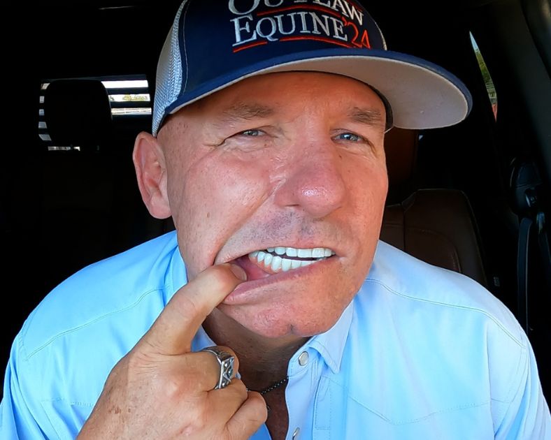 Ricky showing his affordable permanent teeth