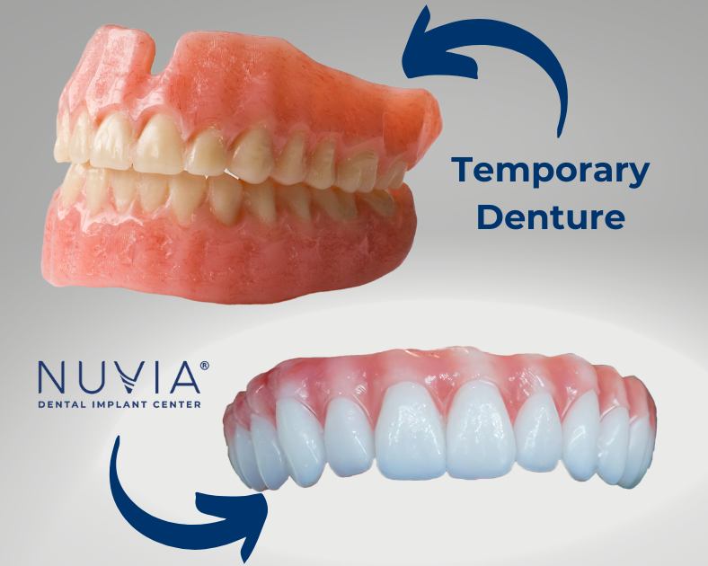 Permanent artificial teeth vs temporary dentures