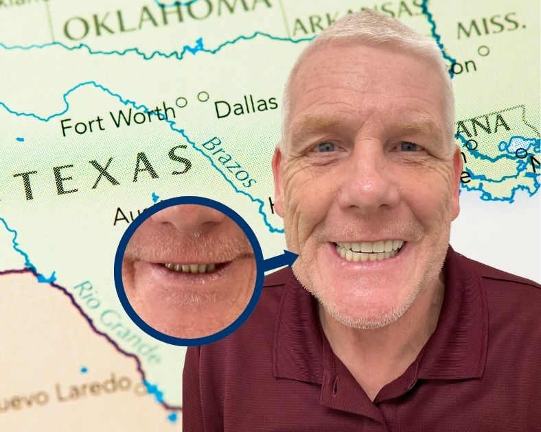 Wayne from Fort Worth Texas after the Dental Implant Procedure