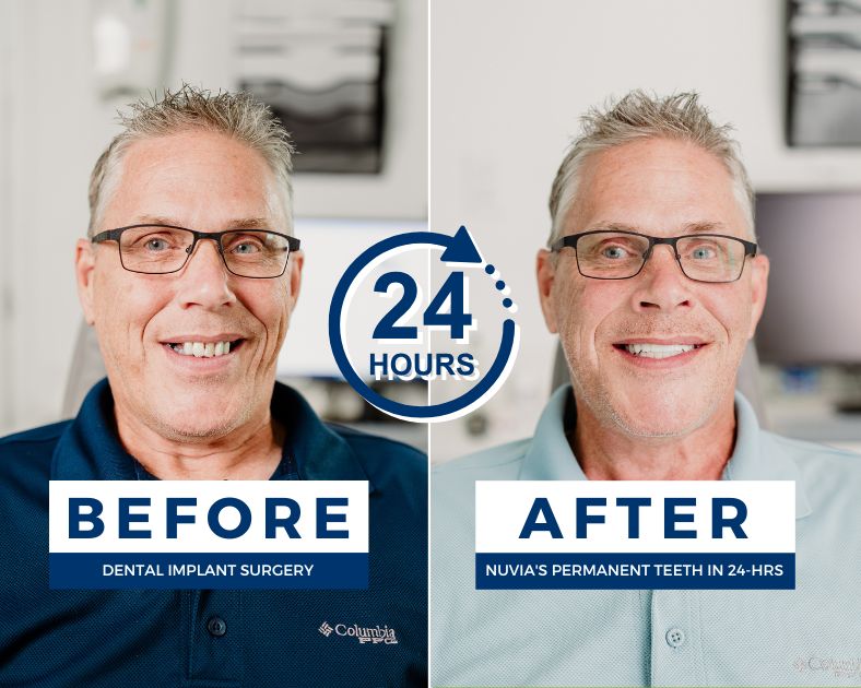 Man smiling before and after dental implants in portland