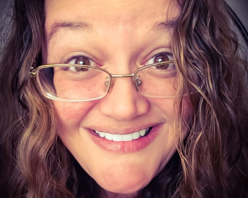 V Smiling after the advantages of dental implants