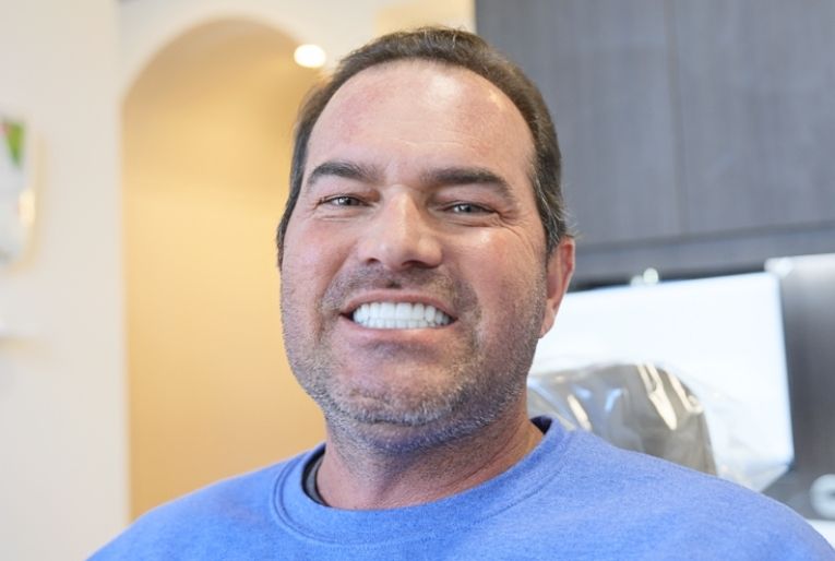 Tom smiling after getting dental implants