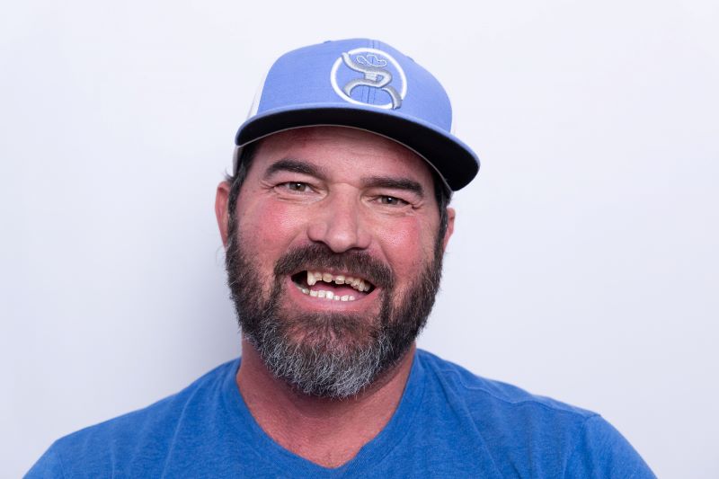 Tom smiling before getting dental implants