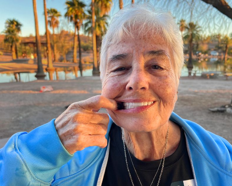 Woman pulling back teeth to show whole mouth implants
