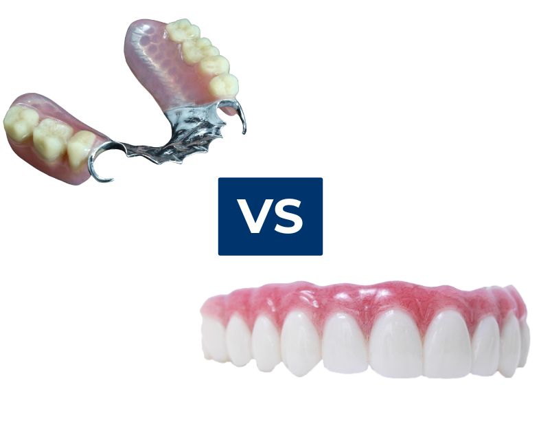 Dentures for back teeth vs dental implants