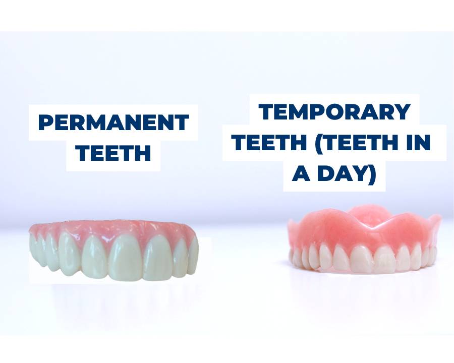 Nuvia permanent teeth made by a prosthodontist in tampa vs temporary teeth