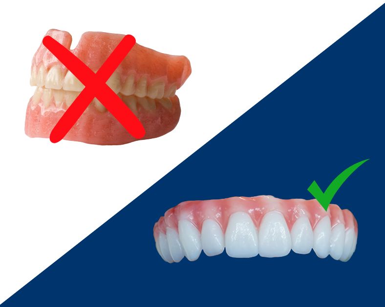 Dentures vs zirconia teeth