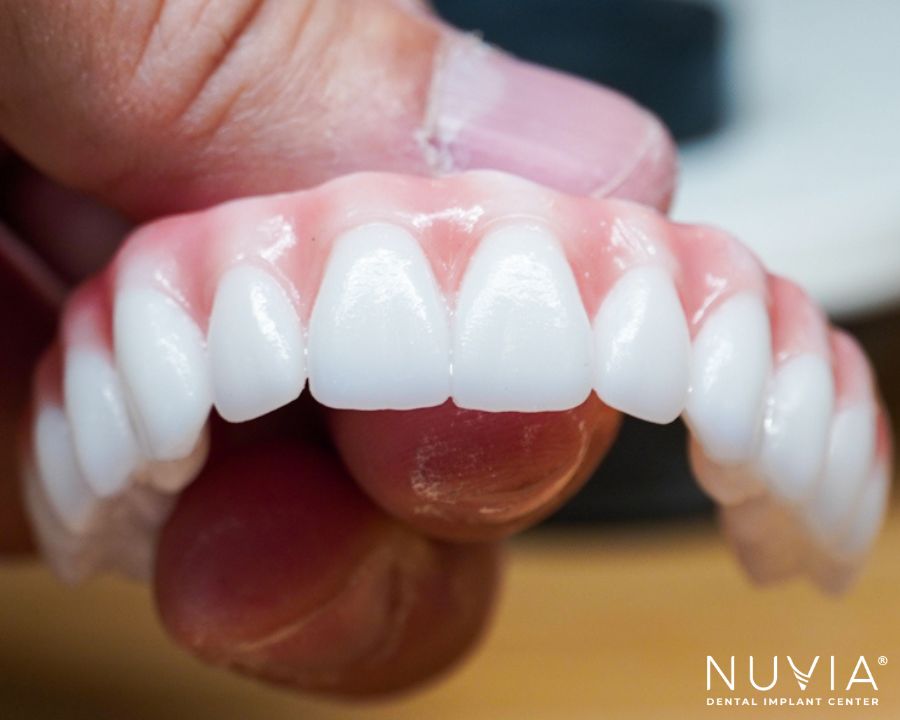 What are dental implants made of? Close up of zirconia teeth