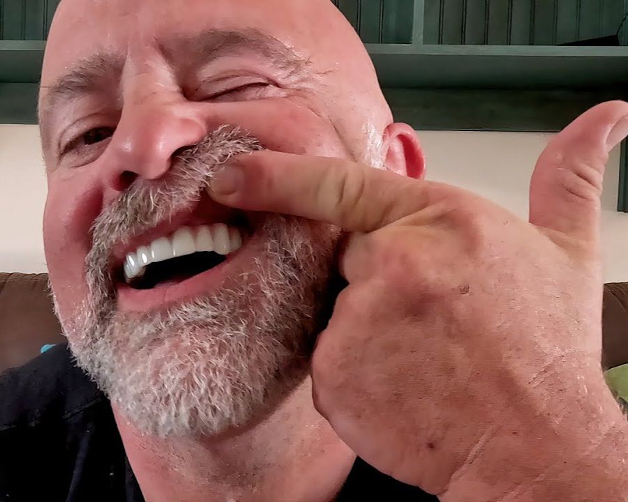 Smiling dental implant patient who no longer has permanent partial dentures