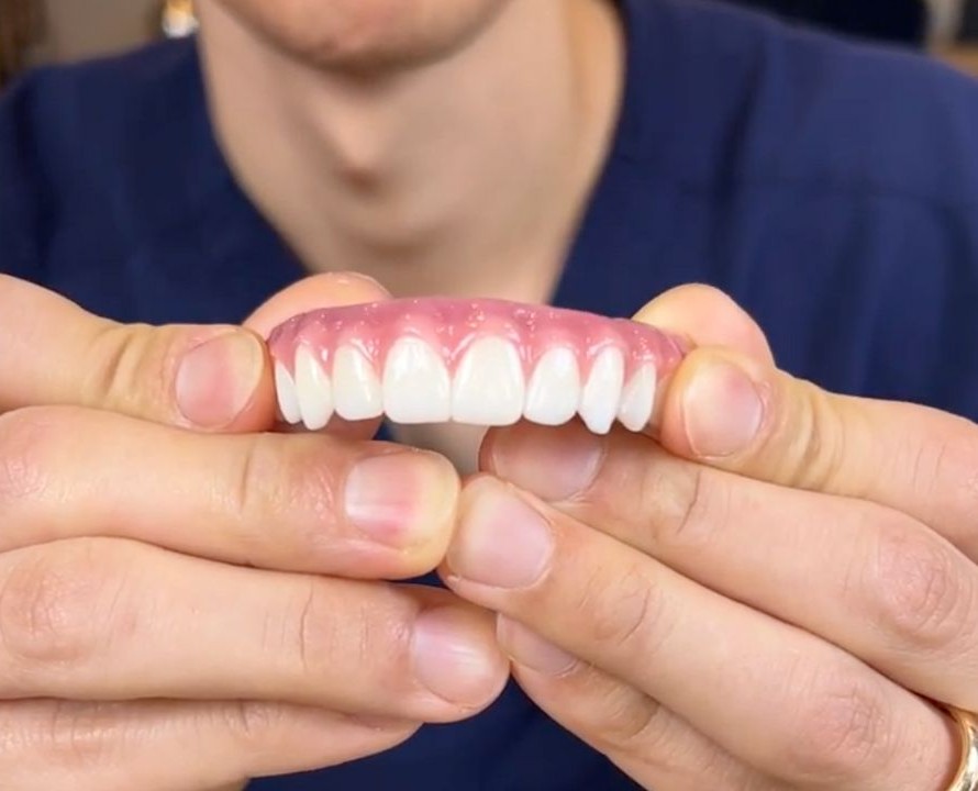 Prosthodonitst holding a set of replacement teeth