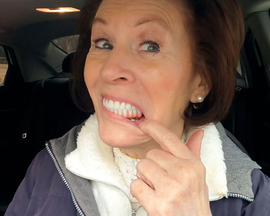 Woman pulling down lip to show what do full mouth dental implants look like