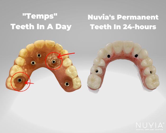 Temporary Teeth in a Day vs Nuvia's Permanent Teeth in 24 Hours