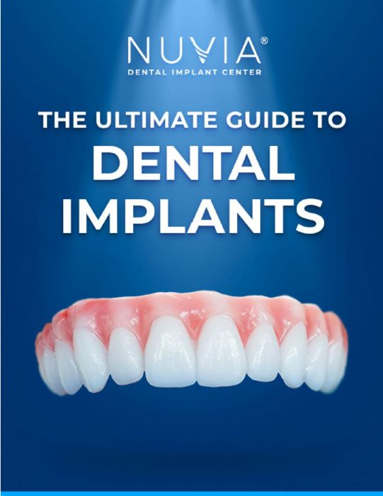 Dental implant cost guide cover