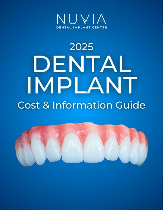 Cover of the 2025 Dental Implant Cost Guide