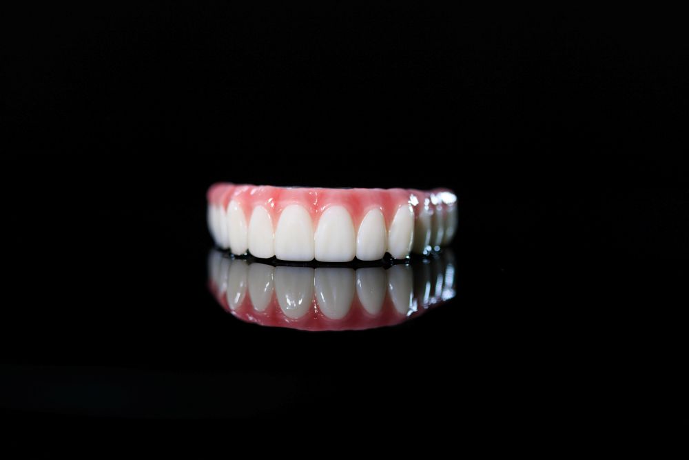 Top set of dental implant arch
