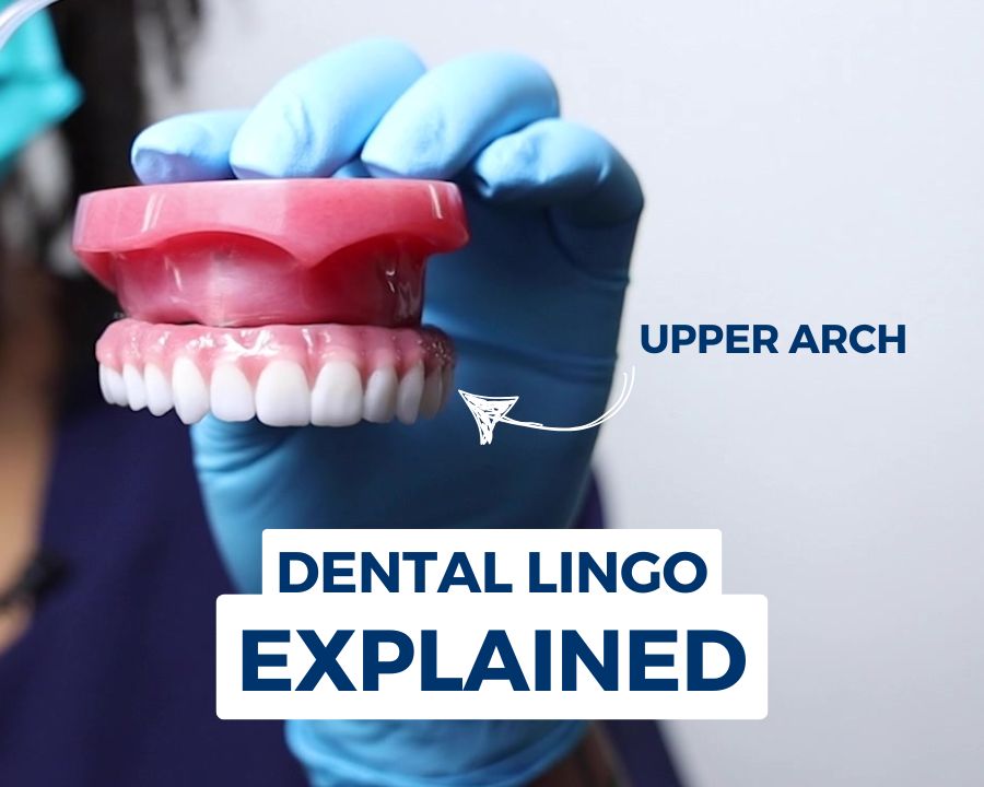 Image of an upper arch of dental implants and text that says "dental lingo explained"