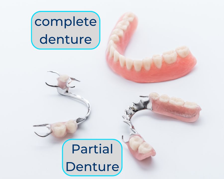 Two sets of partial dentures next to a set of complete dentures