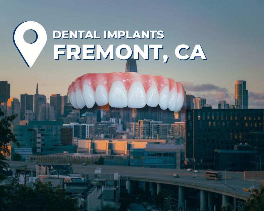 Graphic with dental implant prosthetic in Dallas