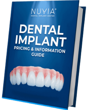 Dental Implant cost guide