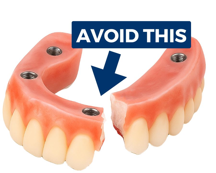 Set of broken fake teeth next to text that says "avoid this"