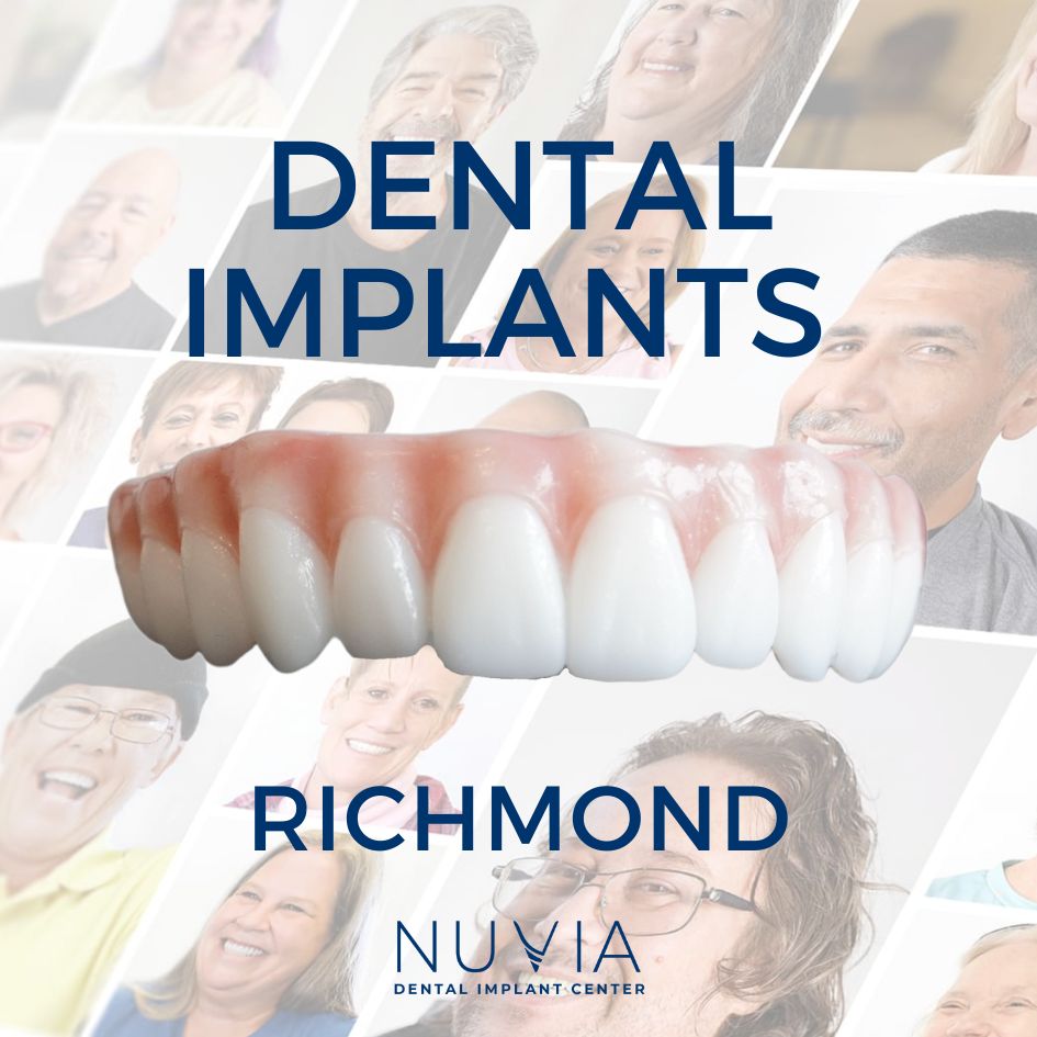 Graphic with dental implant prosthetic in Dallas