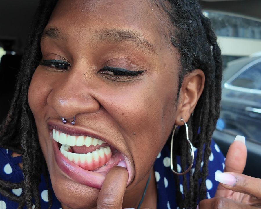 Woman showing close up of her dental implants