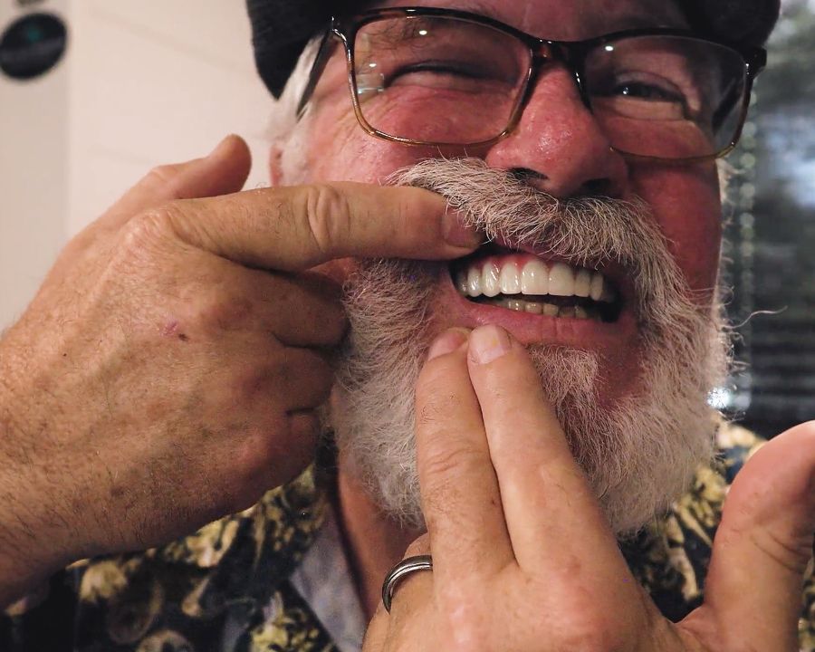 Man showing close up of her dental implants