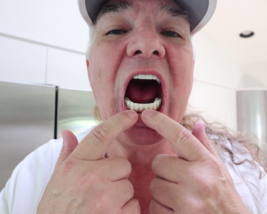Man showing close up of her dental implants