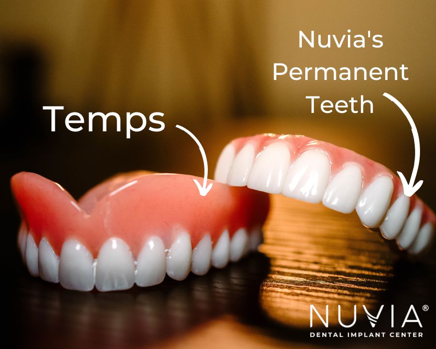 temporary teeth vs nuvia's permanent teeth