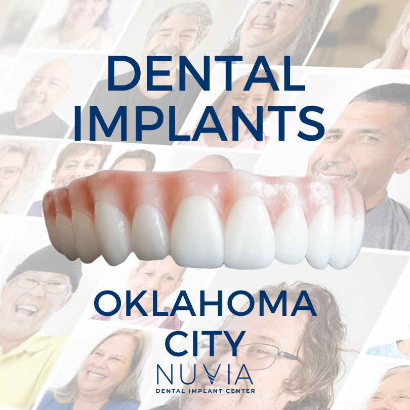 Graphic with dental implant prosthetic in Dallas