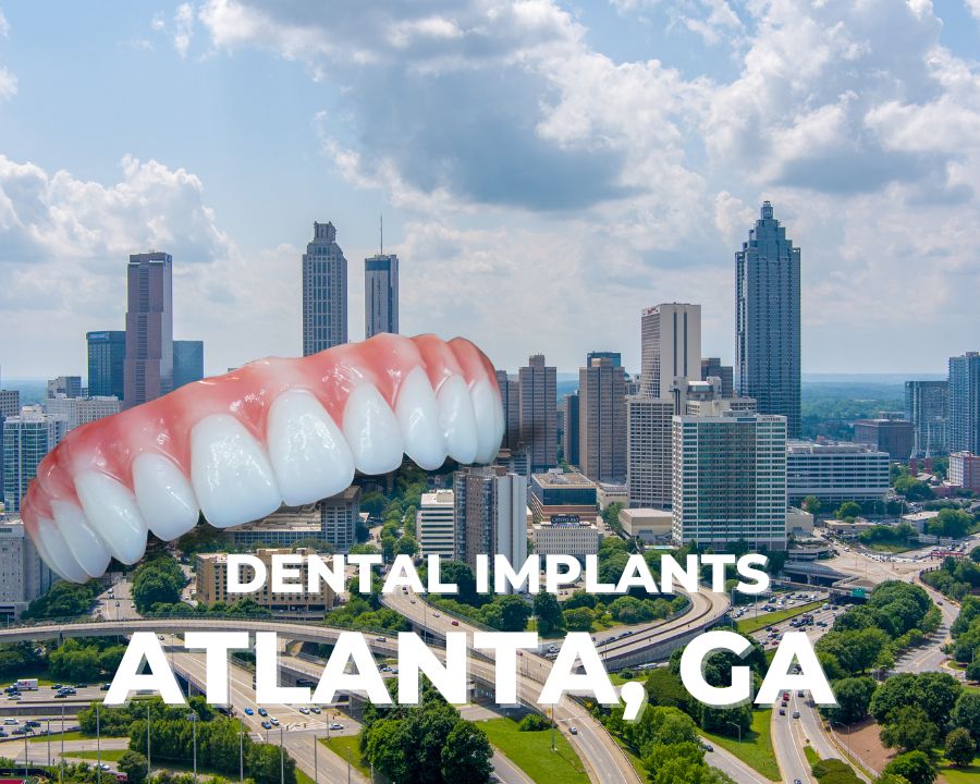 Affordable Dental Implants